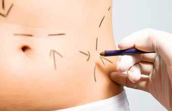 Cirurgia Plastica Dr Tiago Bodanese - Foto 1