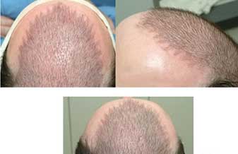 Ademar Nardelli - Foto 1